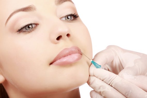 Dermal filler