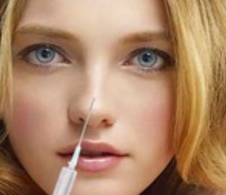 Non-surgical rhinoplasty