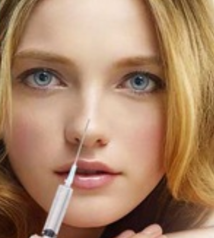 Non-surgical rhinoplasty