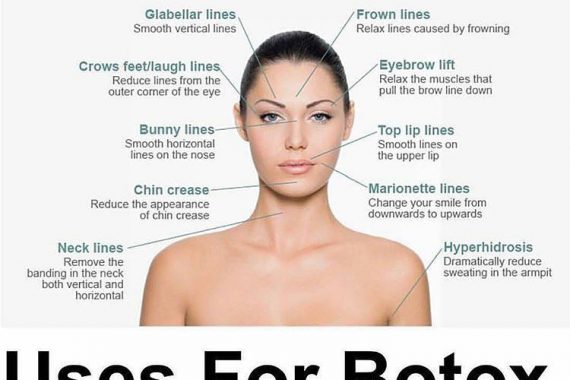 uses of botox