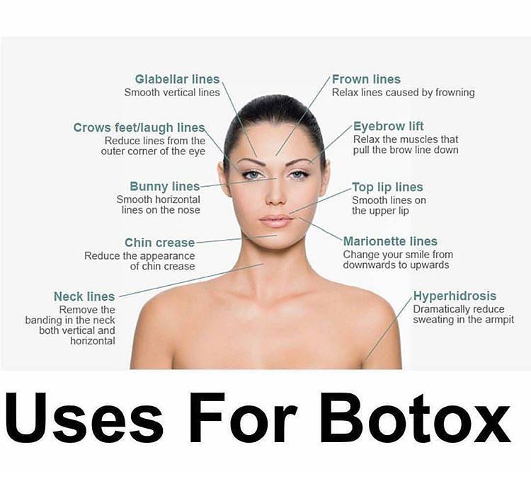 uses of botox