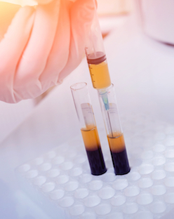 Platelet Rich plasma preparation