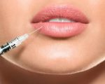 dermal fillers injection